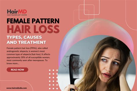 Female Pattern Baldness Causes And Treatment Options