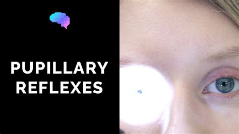 Pupillary Reflexes Osce Guide Clip Ukmla Cpsa Youtube