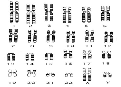 Solved Interpretation Of Picture Of Human Chromosomes 9to5science