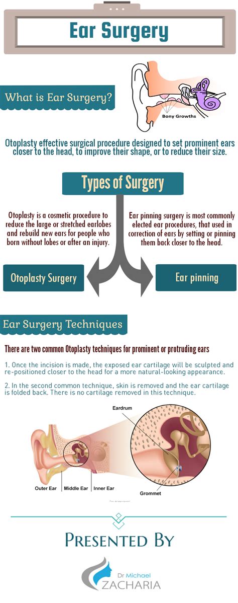 Ear Surgery Procedure Is Usually Done To Move Prominent Ears Closer To