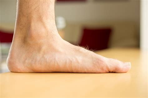 Flat Feet Surgery Treatment For Flat Feet Flatfoot Deformity