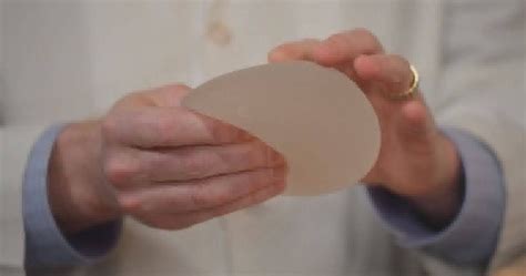 Allergan Recalls Biocell Textured Breast Implants Worldwide National