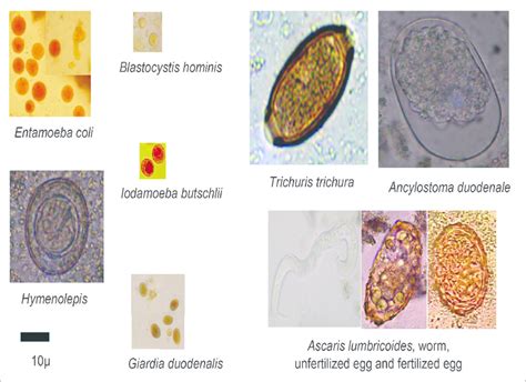 Microscopic Images Of Parasite Ova And Cysts That Were Encountered In