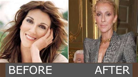 Celine Dion Weight Loss And Health [secret Revealed] Fashionterest