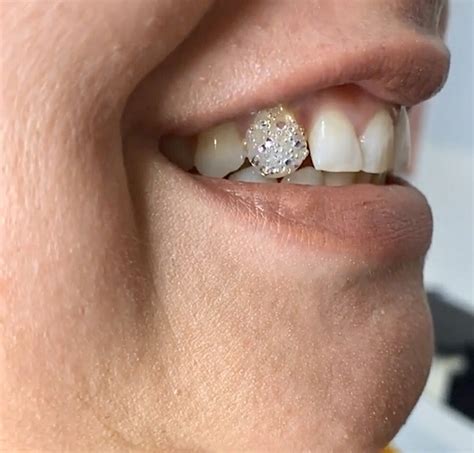 Fairy Dust Swarovski Crystals Applications Swarovski Tooth