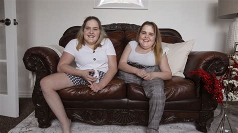 The Amazing Story Of The Connected Herrin Twins How They Look Now History All Day