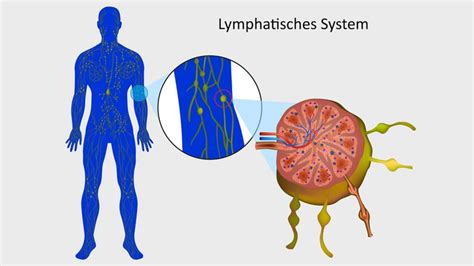 Geschwollene Lymphknoten Welche Ursachen Infrage Kommen