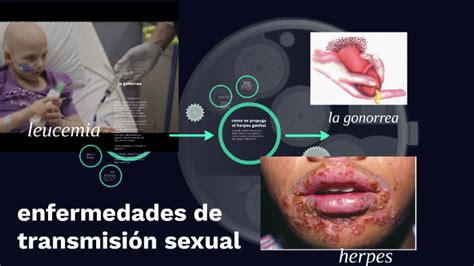 Enfermedades De Transmisión Sexual By Luis Angel Pereira Gutierrez