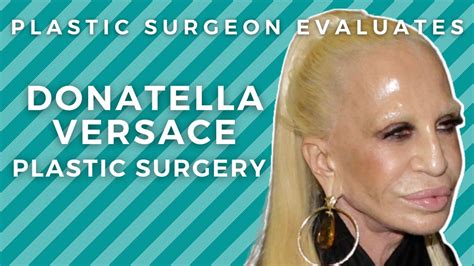 Donatella Versace Before And After Plastic Surgery Silicone Disaster