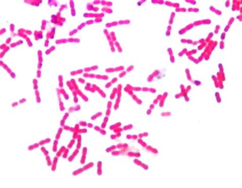 Typical Gram Stain Of K Kingae Showing Pairs Or Short Chains Of