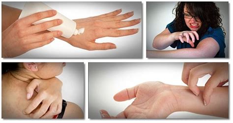 A New “16 Home Remedies For Itching Skin” Article Teaches People How To