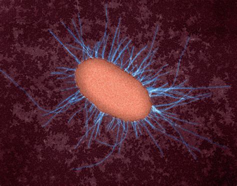 E Coli With Fimbriae Photograph By Dennis Kunkel Microscopy Science My Xxx Hot Girl