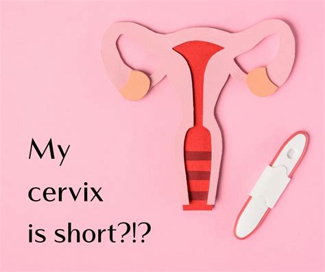 Short Cervix Dr Colin Walsh