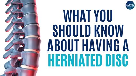 Please note, these are applicable to a bulging disc also. What You Should Know About Having A Herniated Disc - YouTube
