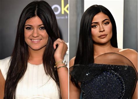 These Before And After Photos Of Kylie Jenner Will Have You Doing A