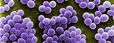 Apa Yang Dimaksud Dengan Bakteri Staphylococcus Aureus Ilmu