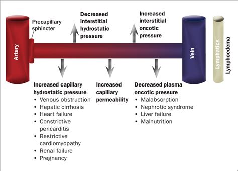 Figure 1 From A Guide To Peripheral Oedema Semantic Scholar