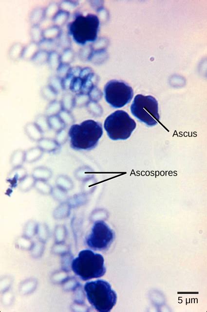 Classifications Of Fungi Openstax Biology 2e