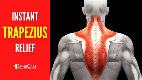 How To Fix Upper Trapezius Pain For Good Spinecare