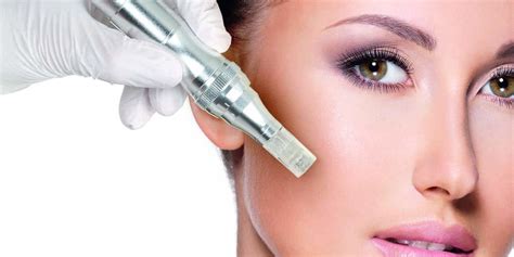 Microneedling All You Need To Know Blog Centrale Fillers
