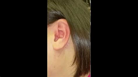 How To Pop Pimple In Ear