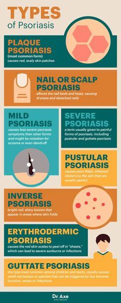 Psoriasis Symptoms And Complications Psoriasis Symptoms Pustular