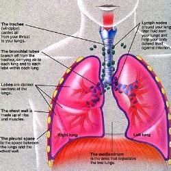 Mesothelioma is a cancer that develops in these linings. Mesothelioma Symptoms And Treatments - Natural Home ...