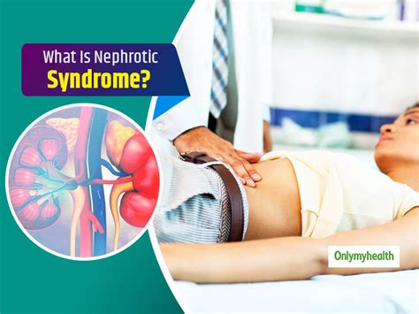 Nephrotic Syndrome Know More About This Disease Its