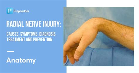 Radial Nerve Injury Causes Symptoms Diagnosis Treatment And Prevention