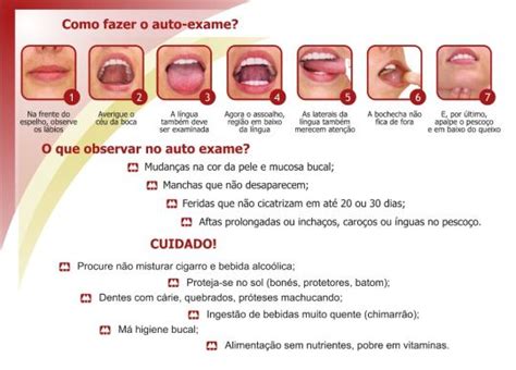 Fa A O Autoexame Da Boca A Preven O Sempre Melhor Dentcare