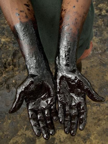 A Chapopero Literally The Tar Man Shows His Oil Covered Hands