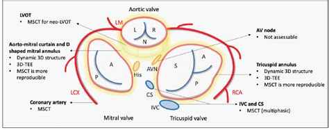 Echocardiographic Imaging In Transcatheter Mitral And Tricuspid Valve