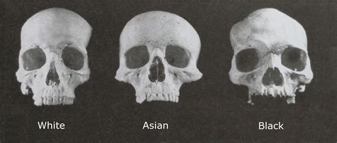 Human Differentiation Evolution Of Racial Characteristics Skull
