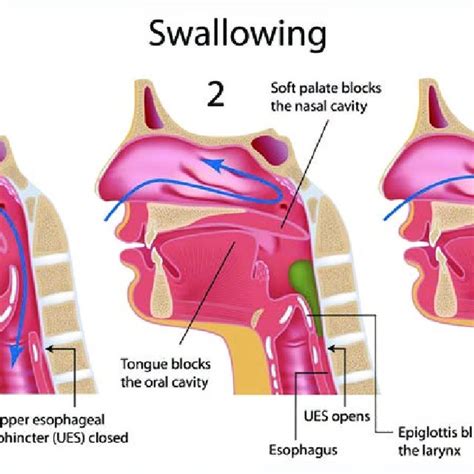 Mealtime Strategies To Ease Swallowing Difficulty Download Table