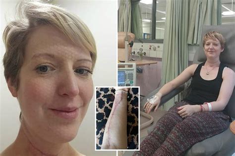 Mum Has Half Her Tongue Cut Out And Rebuilt With Part Of Her Arm After