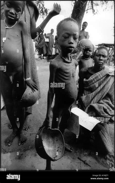 Starving Children Africa Hi Res Stock Photography And Images Alamy