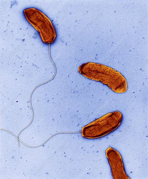 Cholera Bacteria Coloured Transmission Electron Micrograph Tem Of