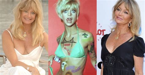 Goldie Hawn Plastic Surgery Before And After Her Facelift Celebritysurgeryicon
