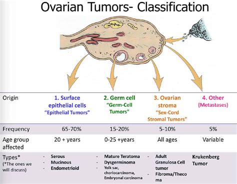 Granulosa Cell Tumor Causes Symptoms Diagnosis Staging Treatment