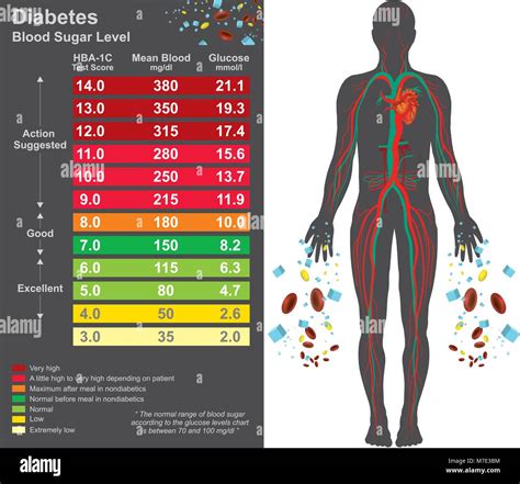 Diabetes Chart Symptoms Of High Blood Sugar Include Frequent Stock