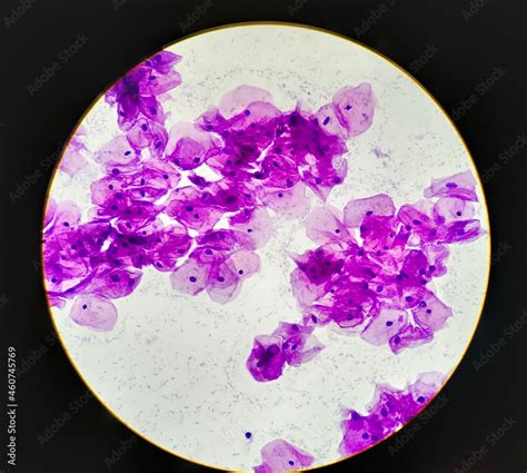 Paps Smear Cytology Microscopic 100x Show Normal Human Cervix Cells