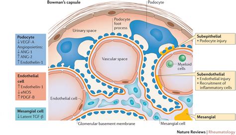 Glomerular Injury In Lupus Nephritis View Of A Glomerular Loop