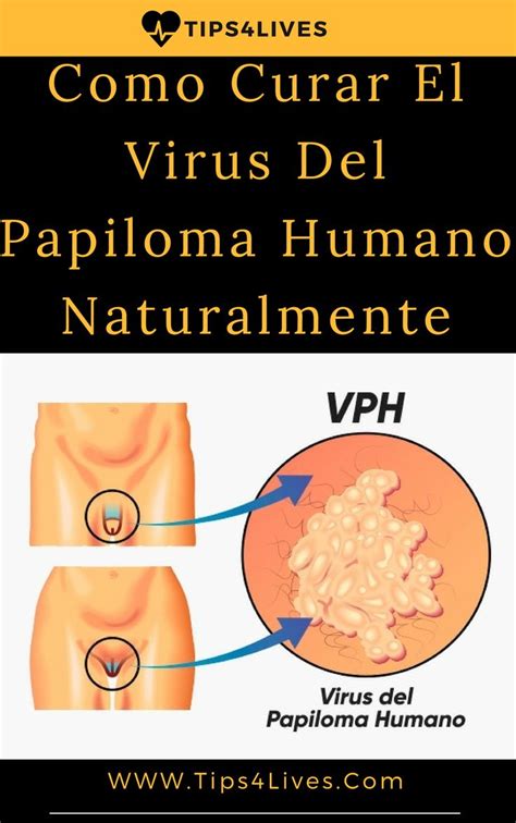 Descubren La Cura Para Eliminar El Los Virus Del Papiloma Humano My Xxx Hot Girl
