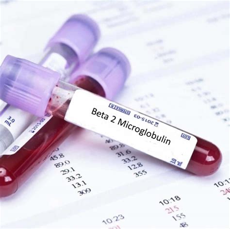 Beta 2 Microglobulin Test Normal Range And Causes Of High Beta 2 Microglobulin
