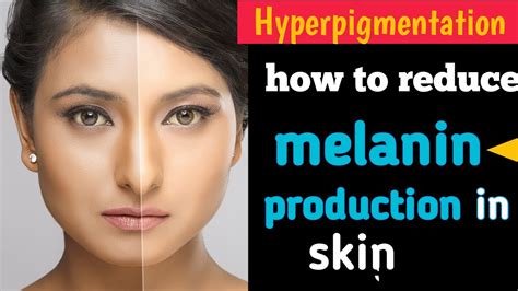 त्वचा में मेलेनिन उत्पादन को कैसे कम करें How To Reduce Melanin Production In The Skin Youtube