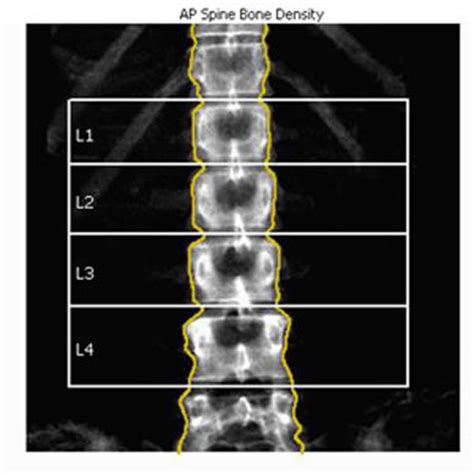 Or, the cause of a symptom may be a different medical condition that is not cancer. Adult survivors of childhood cancer have lower bone ...