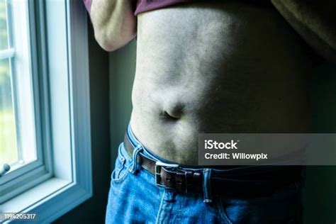 Man Showing Umbilical Hernia Stock Photo Download Image Now Abdomen