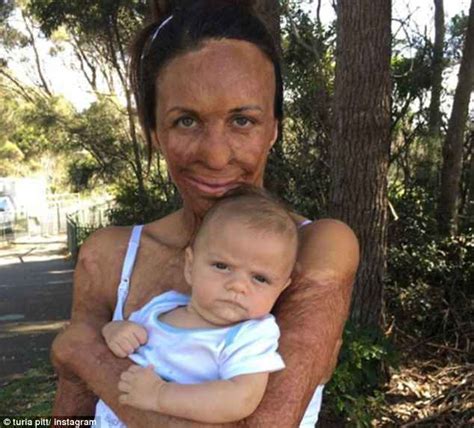 Turia Pitt Reveals Her Struggles With Feeling Inadequate And How She Overcomes A Negative