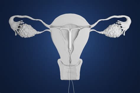 What Women Need To Know About Iuds Facty