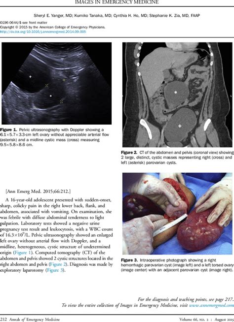 It's a really sharp stabbing pain in the left side of my lower abdomen. Abdominal Pain in an Adolescent Female - Annals of ...